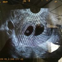 Mamas marzo 2018 - 1