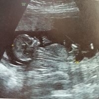 ¡nuevo! futuras mamis marzo 2018 - 1