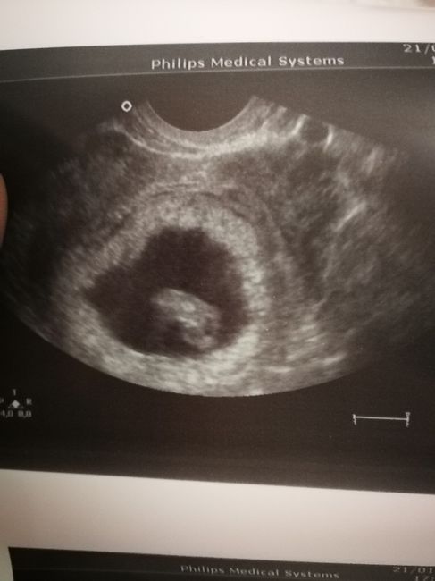 Futuras mamás septiembre 2019 - 1