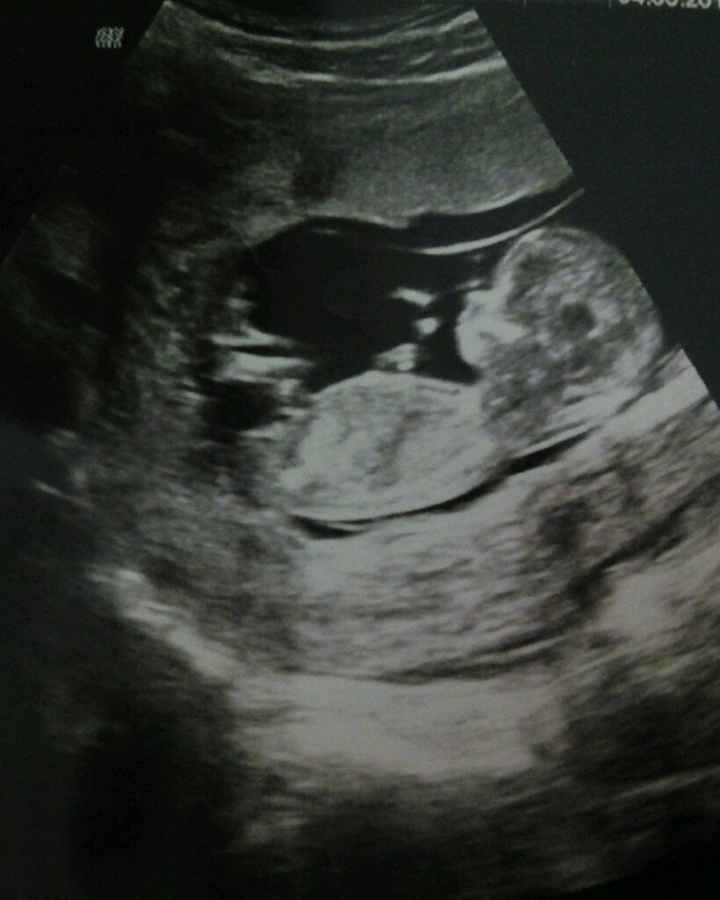 ¡futuras mamis noviembre 2016! - 1
