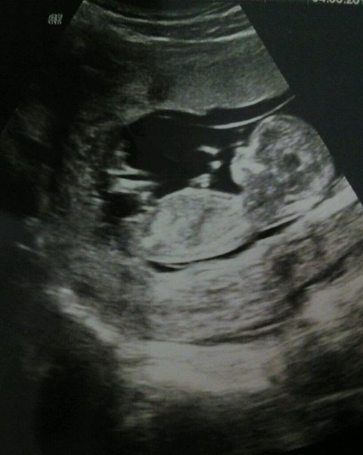 ¡futuras mamis noviembre 2016! - 1