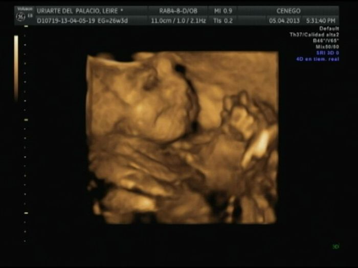 Mi princesa de  casi 27 semanas