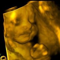 Eco Eva 30 semanas!!