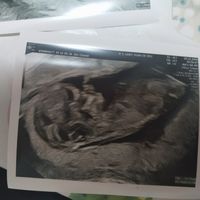 Futuras mamás Junio 2020 - 1