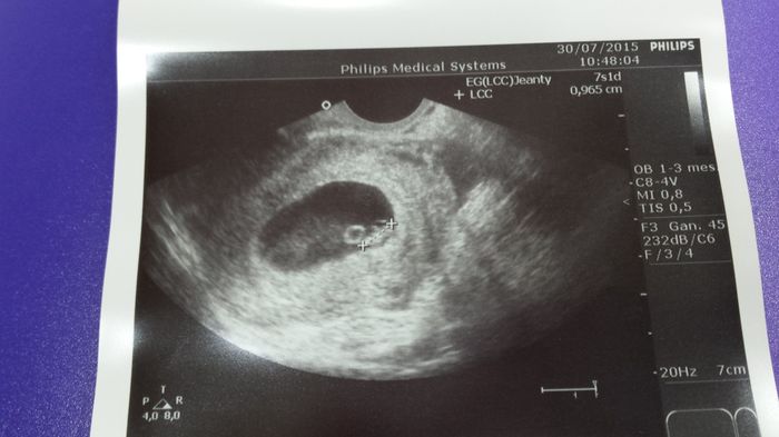 Mamis marzo 2016 - 1