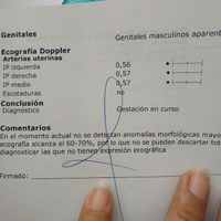 Preeclampsia - siguientes embarazos y prematuros - 2