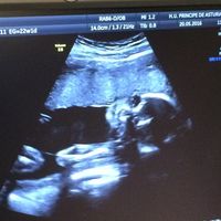 Futuras mamas septiembre 2016 - 1