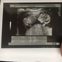 Ayuda con método ramzi: niño o niña? - 1