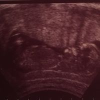  Futuras mamás Abril de 2018! - 1