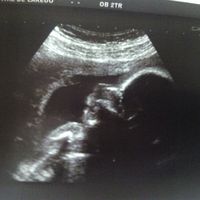 Nuevo futuras mamas enero 2017 - 1