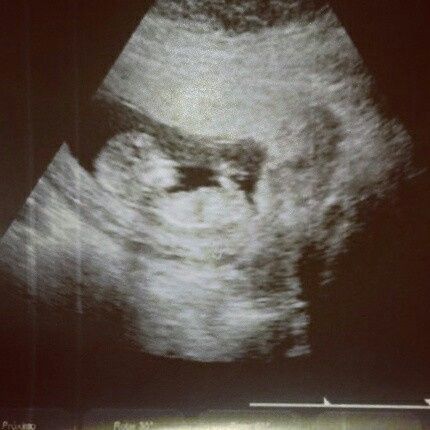 ¡futuras mamis noviembre 2016! - 1