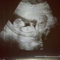 ¡futuras mamis noviembre 2016! - 1