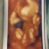 ¡futuras mamis noviembre 2016! - 1