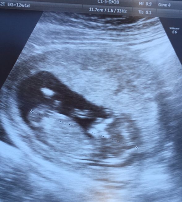 Futuras mamás septiembre 2019 - 1