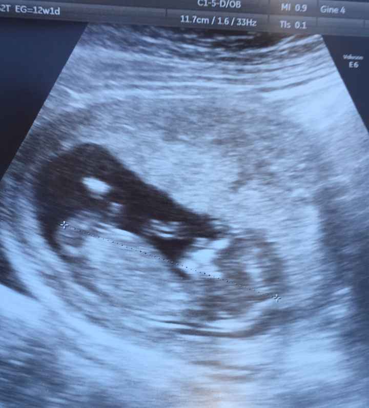Futuras mamás septiembre 2019 - 1