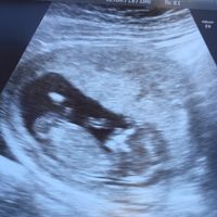 Futuras mamás septiembre 2019 - 1