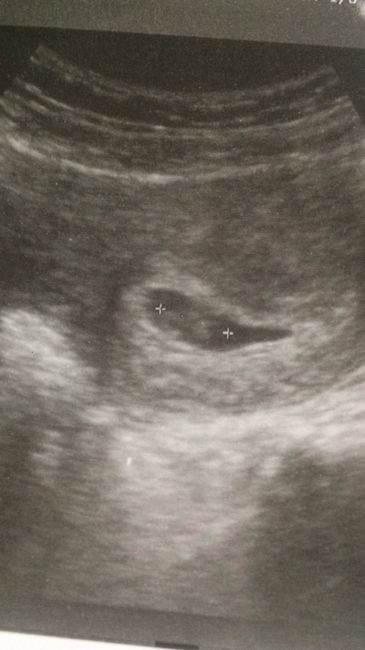 Futuras mamas julio 2019 - 1