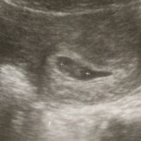 Futuras mamas julio 2019 - 1
