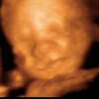 27 semanas