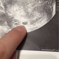 Nuevo! futuras mamis noviembre 2017 - 1