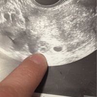 Nuevo! futuras mamis noviembre 2017 - 2