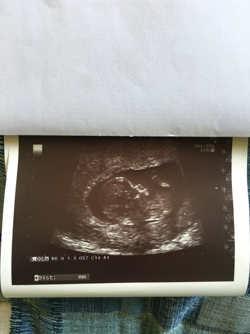 Futuras mamás agosto 2018 1