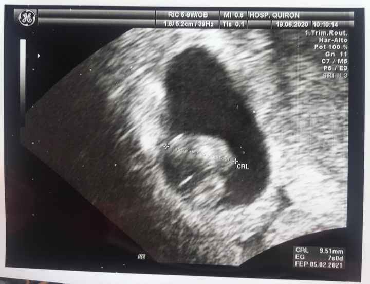Futuras mamis Febrero 2021 - 1