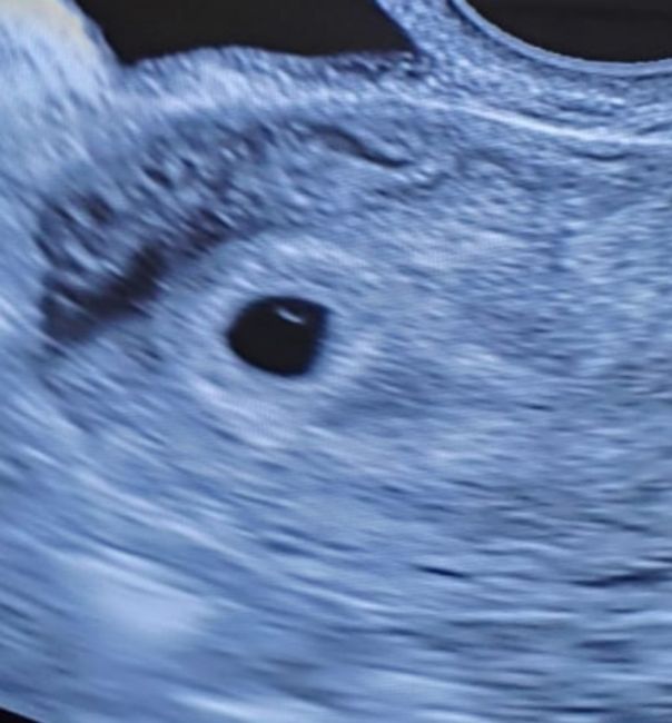 Futuras mamis Junio 2022!! 1