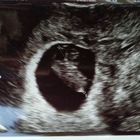 Futuras mamis Marzo 2021 ❤️❤️ - 1