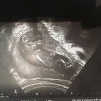 Niño o niña - 1