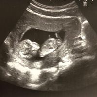 Niño o niña - 2
