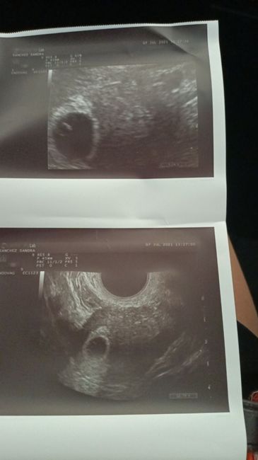 💞 Futuras Mamis marzo 22 🤰🏼 - 1