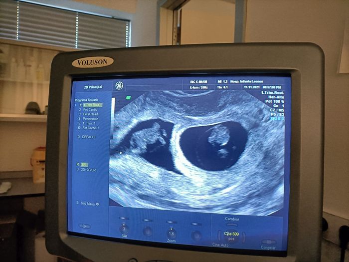 Futuras mamis Junio 2022!! 2