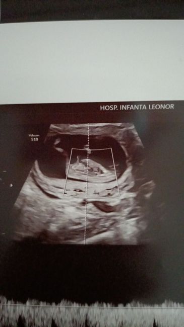 Futuras mamis Junio 2022!! 3