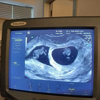 Futuras mamis Junio 2022!! - 1