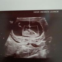 Futuras mamis Junio 2022!! - 1