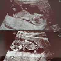 Futuras mamis Junio 2022!! - 1