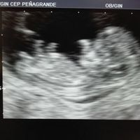 El consultorio de Lita para futuras mamis - 1