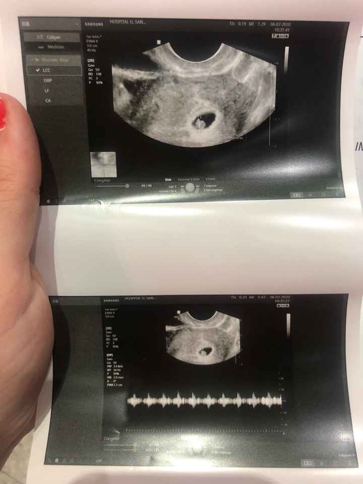 Futuras mamis Marzo 2021 ❤️❤️ - 1