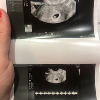 Futuras mamis Marzo 2021 ❤️❤️ - 1