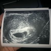 Futuras mamás julio 2021🤰🌹😍😍 - 1