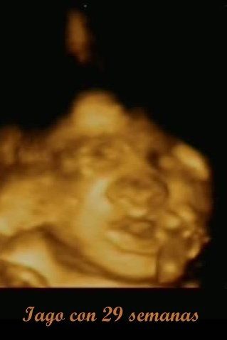 ¡¡futuras mamás agosto 2016!! - 2