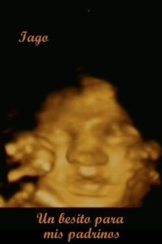 ¡¡futuras mamás agosto 2016!! - 3