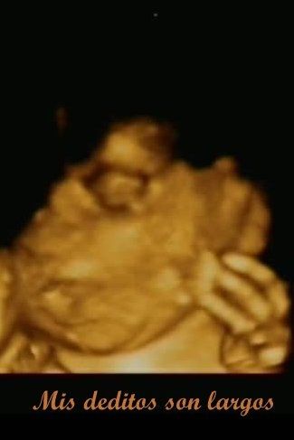 ¡¡futuras mamás agosto 2016!! - 4