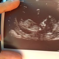 Futuras mamás marzo 2019 - 1