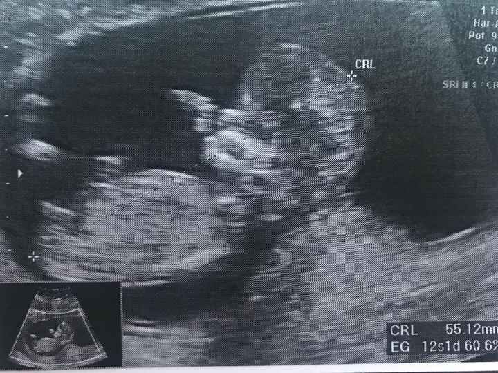 12 semanas