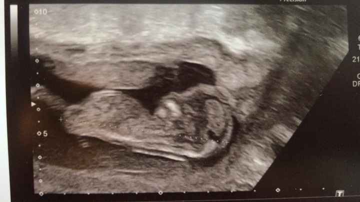 13 semanas