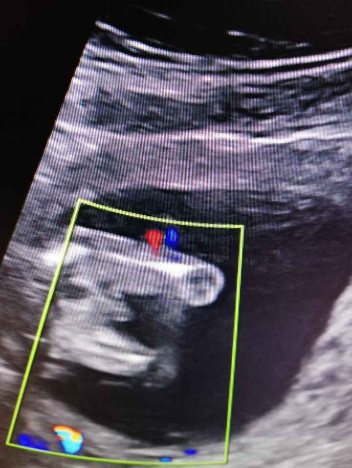 15 semanas