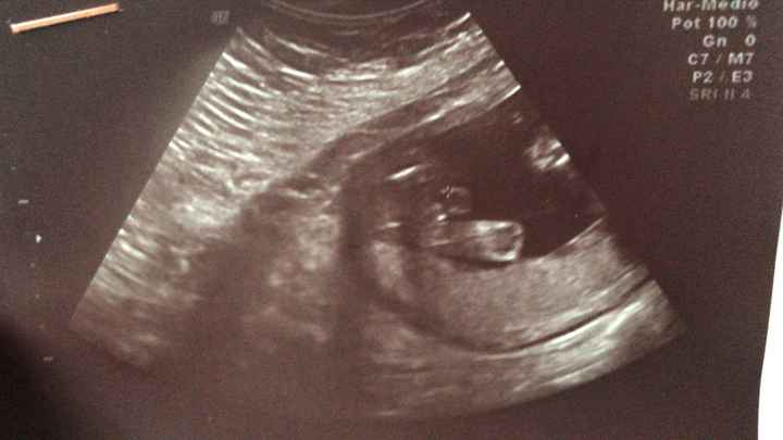17 semanas