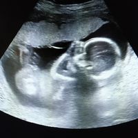 Mamis Octubre 2019 - 1